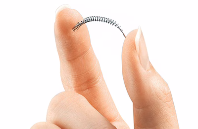 anticonceptiemiddel-essure.avif